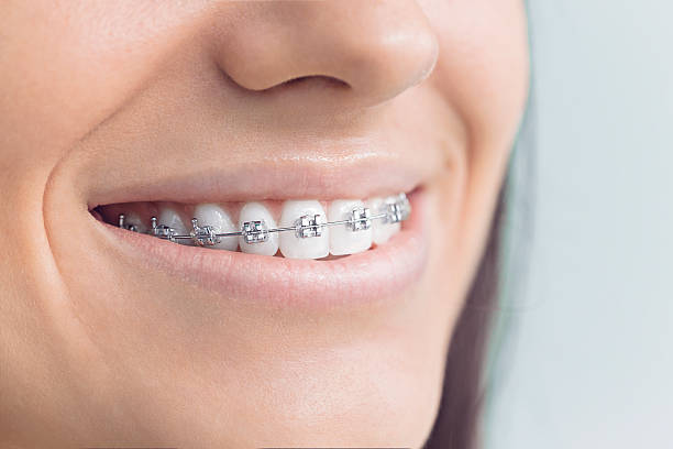 Best Cosmetic Dentistry  in Lodi, OH